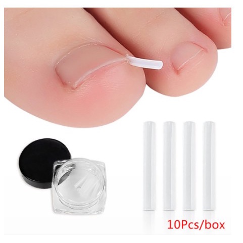 1pcs Bantalan Silikon koreksi Kuku Ingrown Nail Isolation Pad kuku