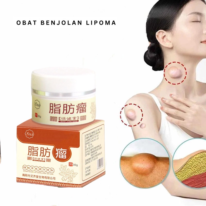 Obat Benjolan Lipoma Krim Benjolan Di Leher / Tangan / Ketiak / Punggung Pundak / Kaki Selangkangan Telinga Gondok Hipertiroid Kelenjar Tiroid Limfoma Limpoma Kelenjar Obat Herbal 30g