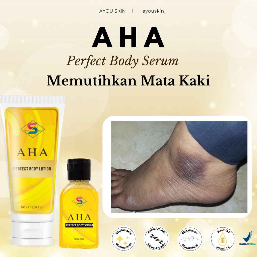 Pemutih Mata Kaki Yang Hitam, Penghilang Hitam Di Mata Kaki, Penghilang Mata Kaki Hitam Ampuh, Cream