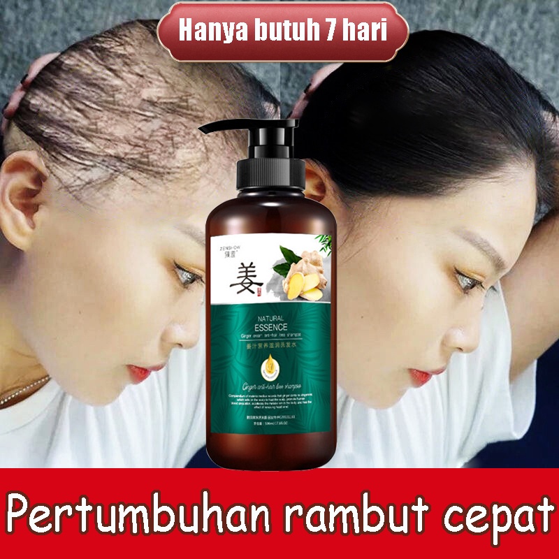 HAIR TREATMENT Shampoo Anti Rambut Rontok Hair Fall Shampo Penumbuh Pemanjang 400ml Penghitam Rambut Anti Rontok Ketombe Origina/Penghitam Rambut /Anti Rontok Ketombe/Ketombe