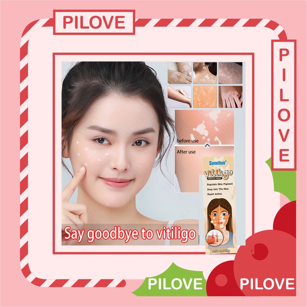 PILOVE - Cream Krim Obat Penghilang Penyembuh Vitiligo Salep Krim Cream Vitiligo Treatment Kulit Bercak Belang Bintik Putih di Bibir Wajah Original Paling Ampuh 100%