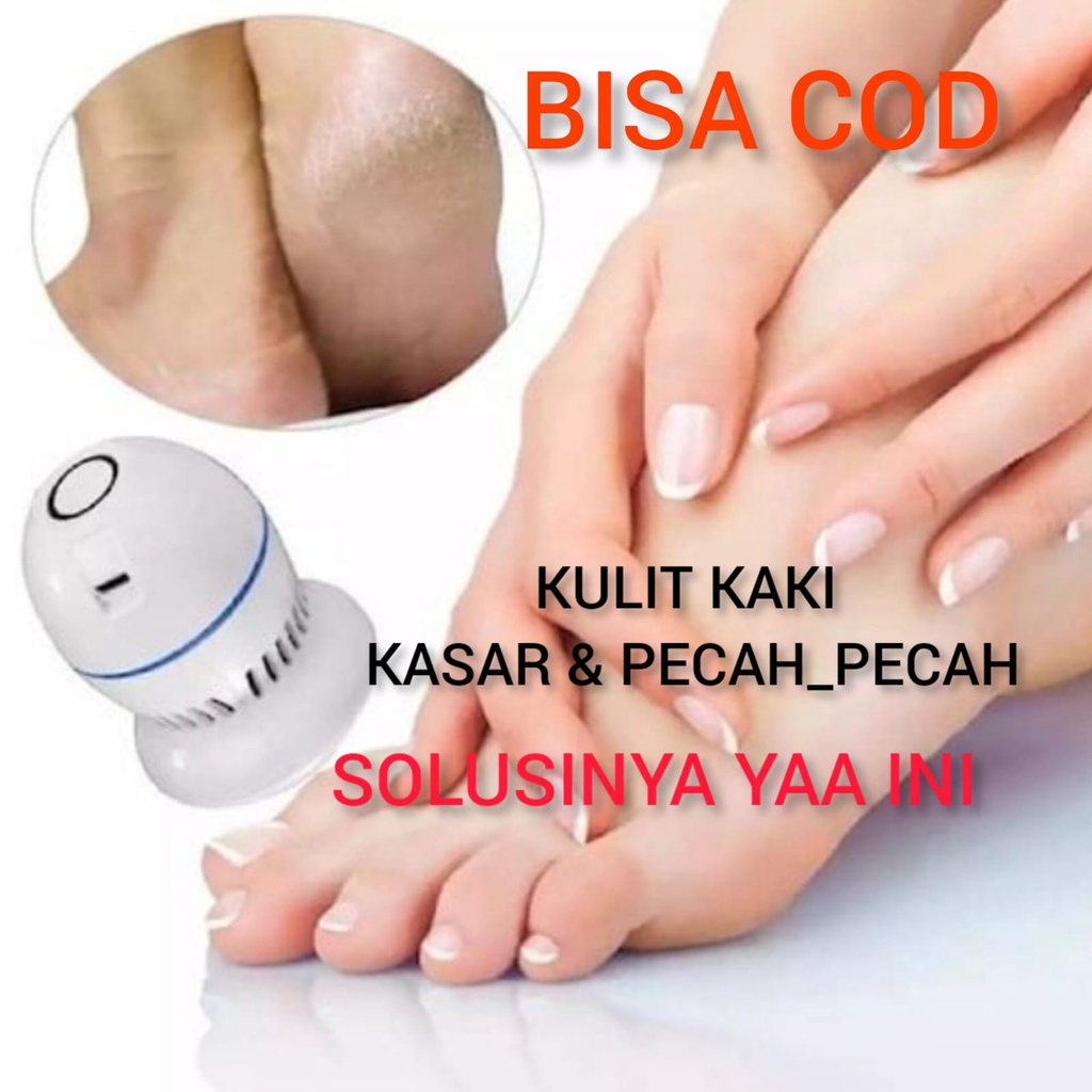 Alat Pembersih Penghalus Kulit Tumit Kaki Mati Pecah Dan Kasar Callus Remover