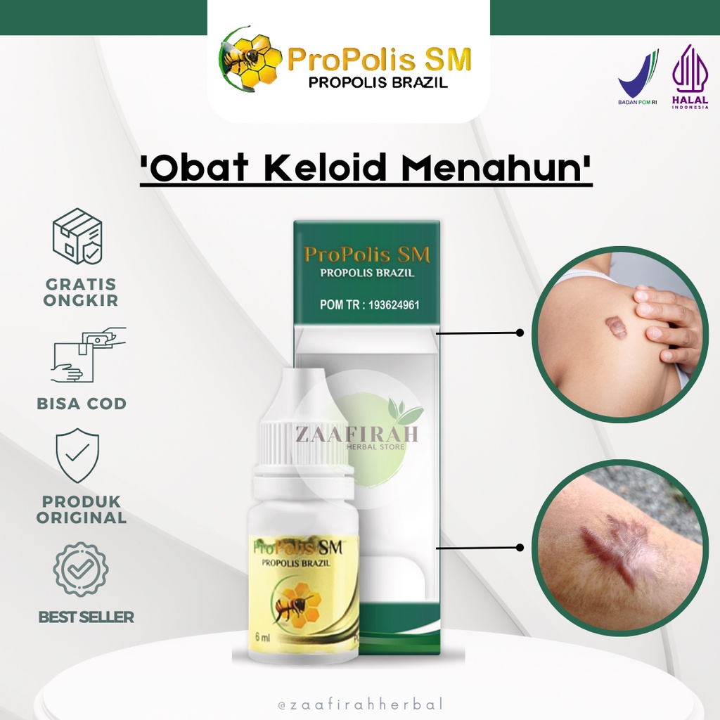 Obat Penghilang Keloid Bekas Luka Menonjol Keloid Menahun Bekas Luka Lama Bekas Jahitan Bekas Operas