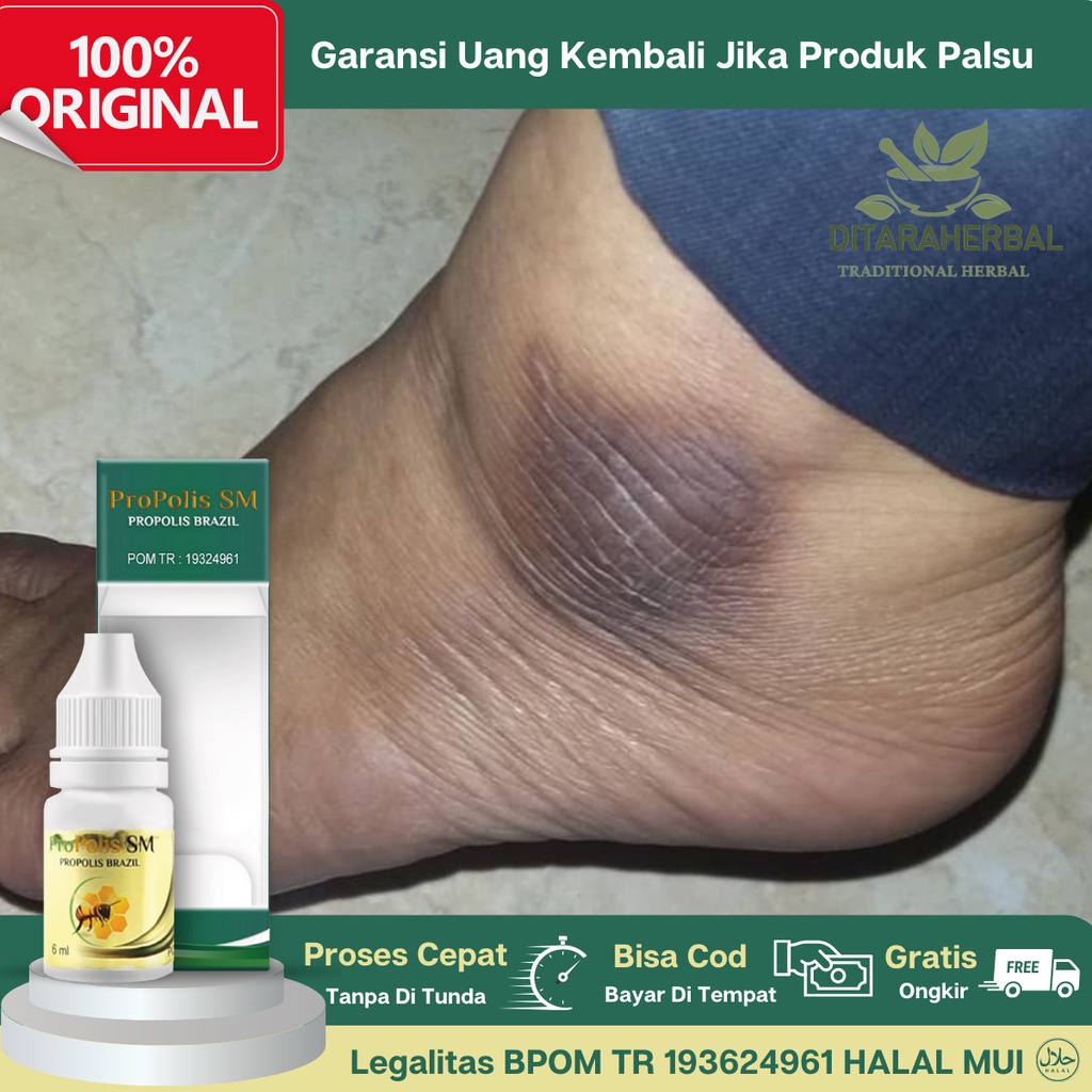 Obat Pemutih Mata Kaki Hitam, Obat Oles Mata Kaki Hitam, Obat Mata Kaki Kering, Obat Mata Kaki Kasar