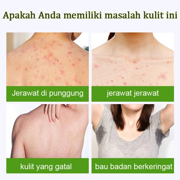 Acne body wash sabun jerawat sabun mandi 500ml Apsintus shower gel, sabun pemutih badan, anti gatal, anti bakteri, anti jerawat, tungau punggung, wangi tahan lama, kering/gatal/biang keringat