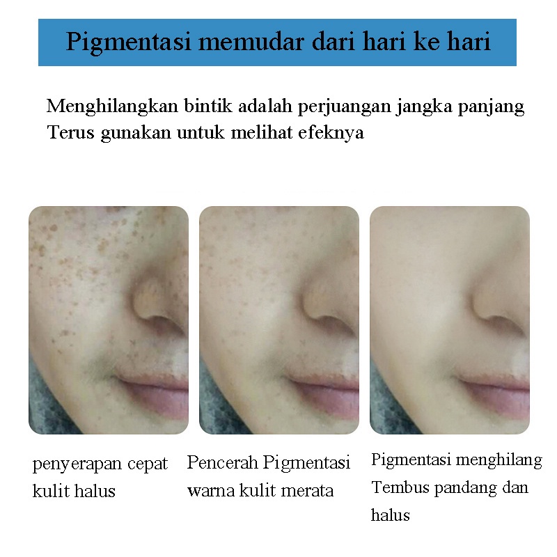 Cream Penghilang Flek Hitam Krim Penghilang Flek Cream Pemutih Wajah 30g Pemutih Asli Dan Penghilang Bintik Memudarkan Bintik, Bintik Matahari, Melasma Dan Melanin