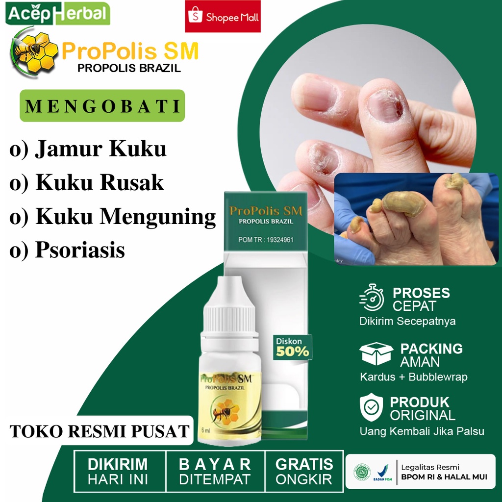 Obat Jamur Kuku Dan Rusak Kuku Kuning Psoriasis Obat Tetes Untuk Kuku Propolis SM