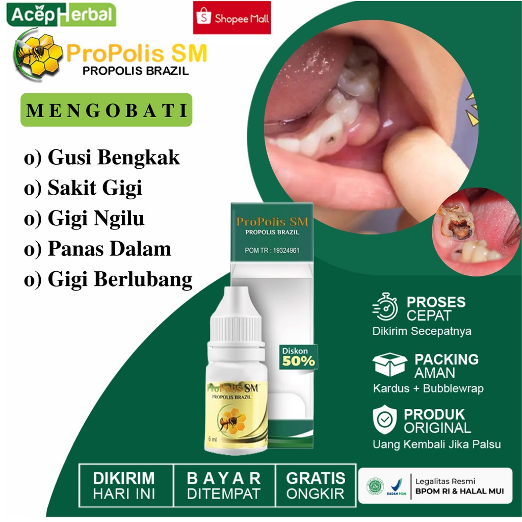 Obat Gusi Bengkak, Sakit Gigi, Gigi Ngilu, Panas Dalam, Gigi Berlubang, Obat Tetes Sakit Gigi Propol