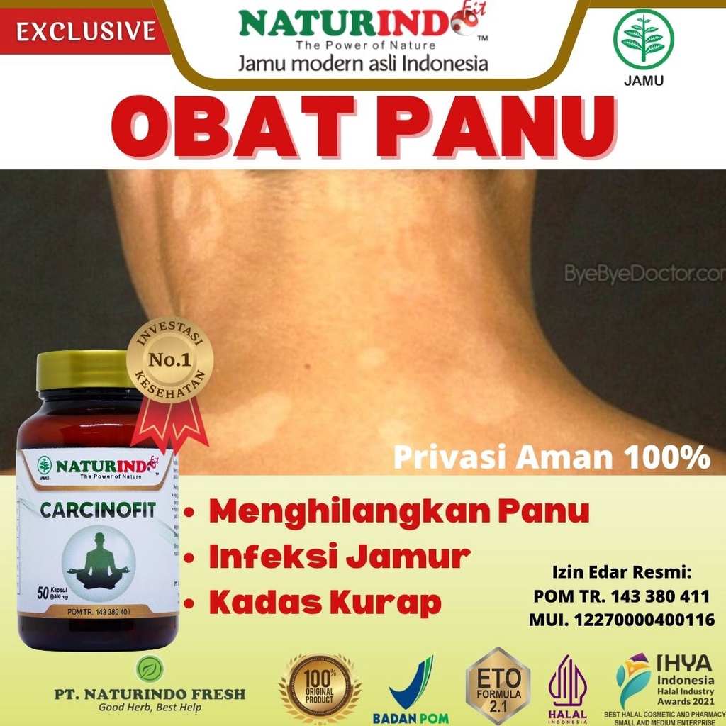 Obat Panu Paling Ampuh 100% Dan Paling Cepat Permanen Untuk Anak Dewasa Di Wajah Leher Tangan