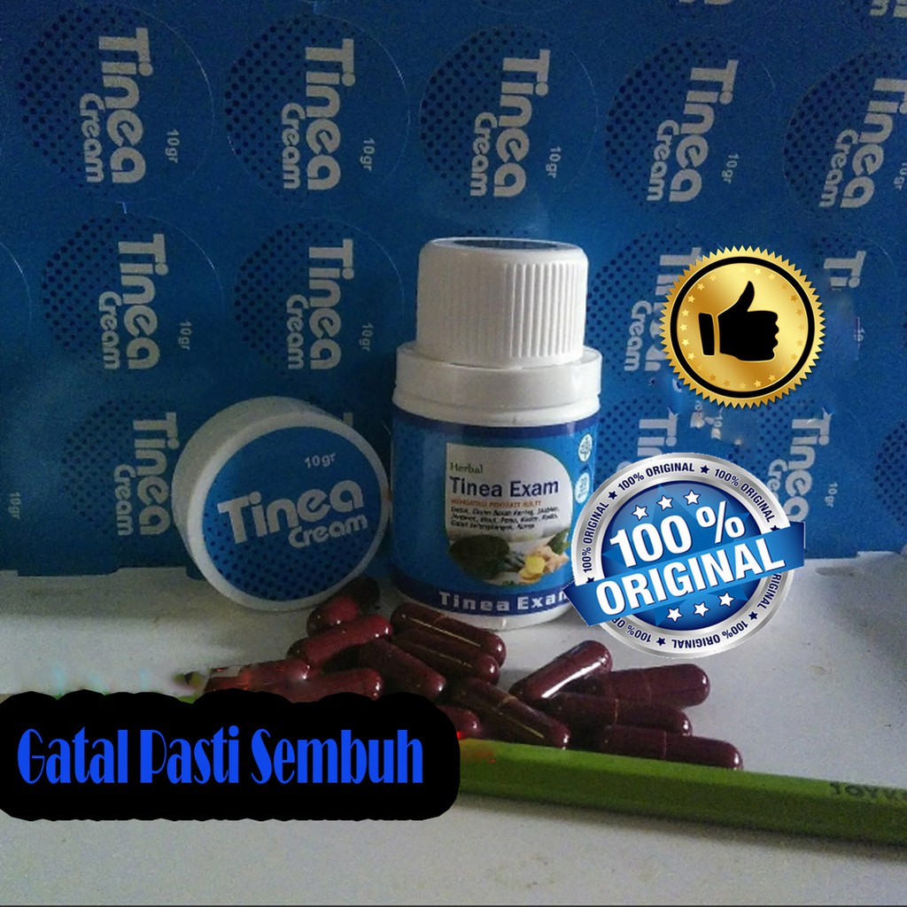 Tinea Obat Gatal Seluruh Badan