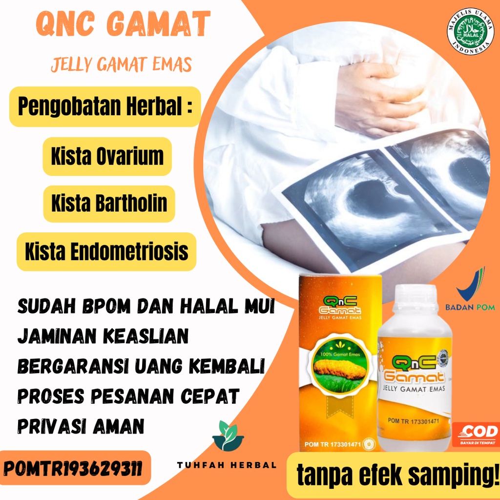 Obat Kista, Kista Ovarium Kista Bartholin Kista Endometriosis Kista Ganglion Kista Coklat Lipoma Tir