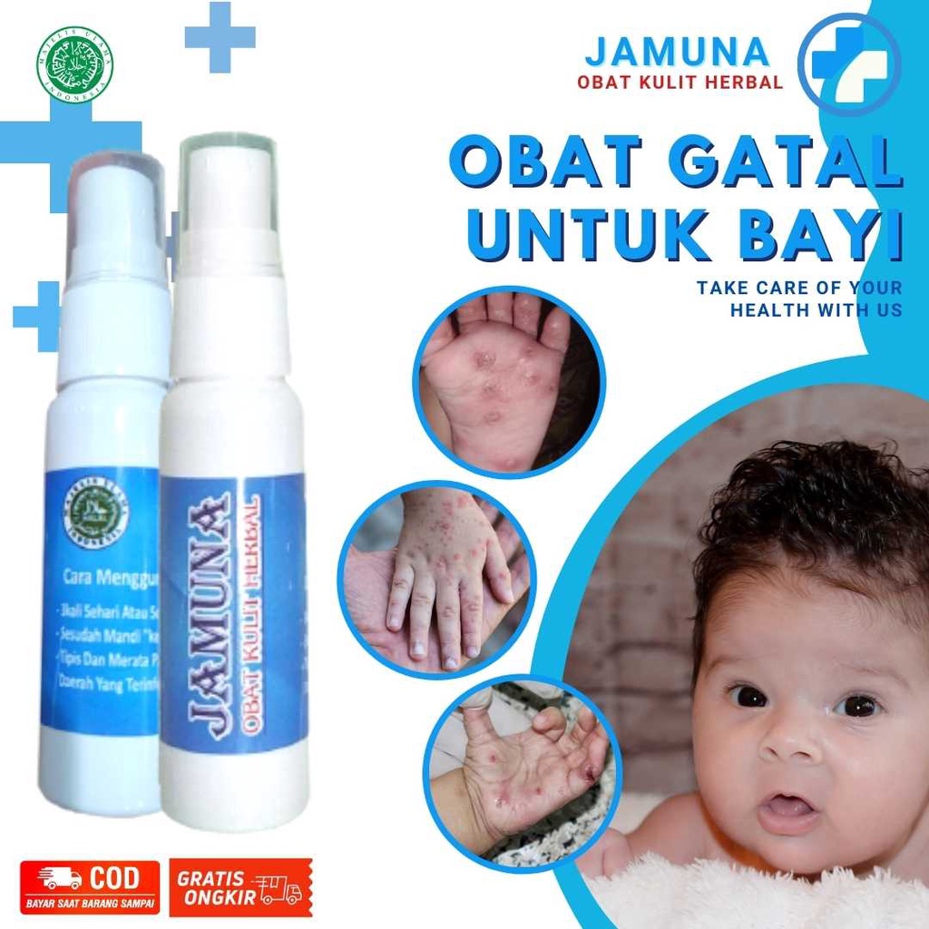 Obat Gatal Paling Ampuh