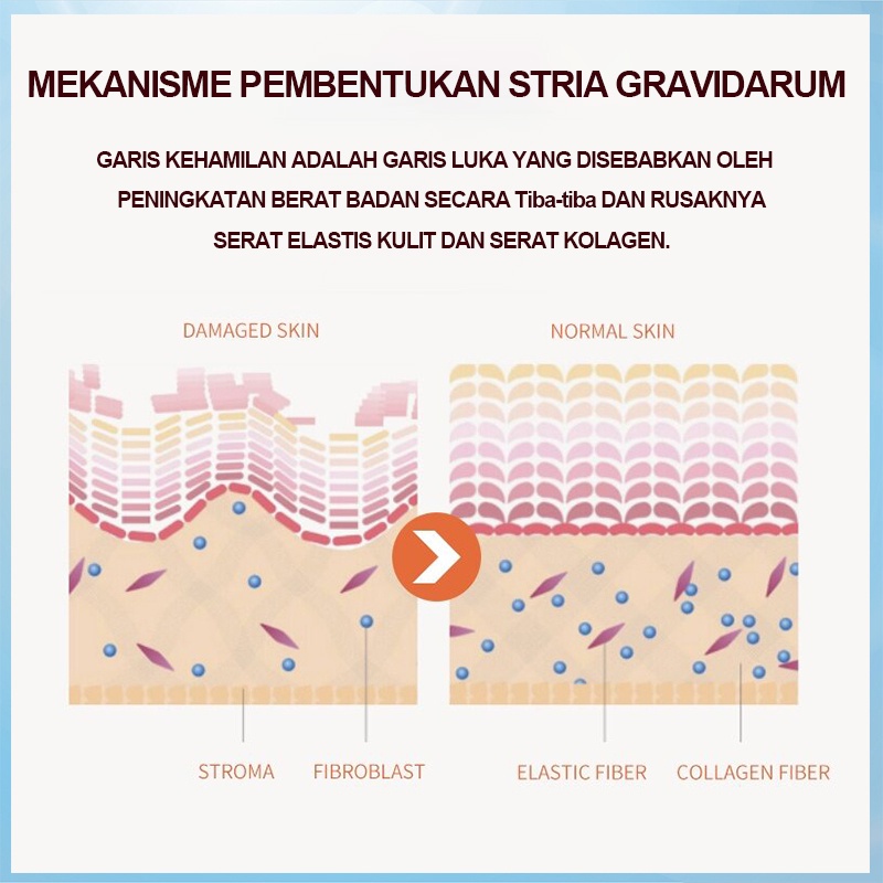 Strechmark Cream Pregnancy Cream Krim Stretch Mark Penghilang Strechmark 60g Krim penghilang bekas luka Krim perbaikan kerut untuk wanita hamil untuk memudarkan luka bakar dan luka bedah untuk menghilangkan bekas luka abadi Perawatan Tubuh