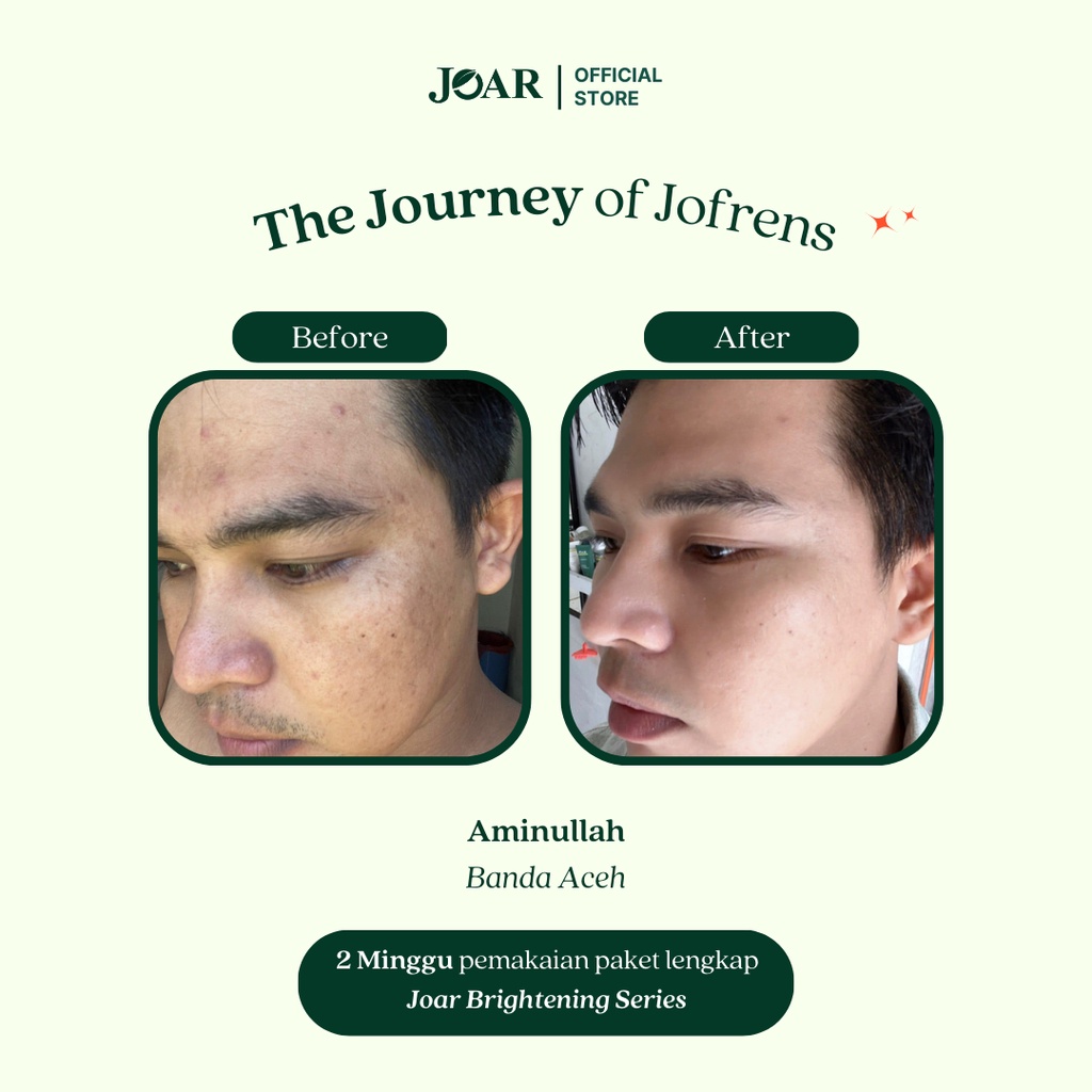 Joar Skincare [2 Pcs] Series Brightening (Soap Bar/Sabun, Serum, Day Cream, Night Cream &amp; Face mist)