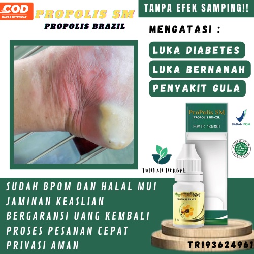 Obat Luka Diabetes Basah Bernanah, Obat Luka Bernanah Penyakit Gula, Obat Luka Gula Menahun, Obat Pe