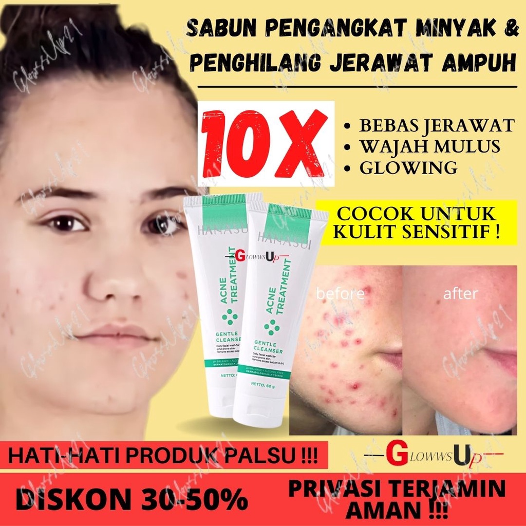 HANASUI ACNE TREATMENT GENTLE CLEANSER 60GR - SABUN WAJAH HANASUI ACNE