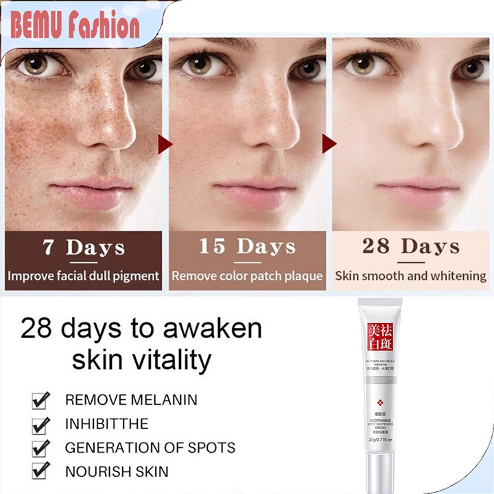 Whitening Set 4in1 Paket Perawatan Whitening-Whitening Freckle Remove Dark Spots Anti Freckle Cream Niacinamide Fade Pigmentation Melasma Brighten Creams concealer focallure