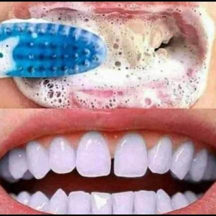 Odol Pemutih Gigi - Orecare Toothpaste