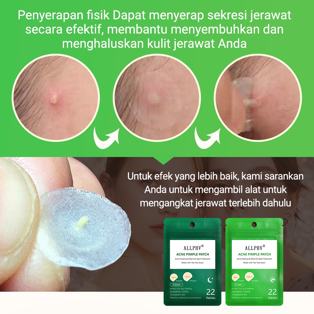 [Grosir] Allphv Acne Patch Pimple Removal Penghilang Jerawat Day Use 0.1mm and Night Use 0.3mm Acne Treatment Ready Stock(22 sticker jerawat)
