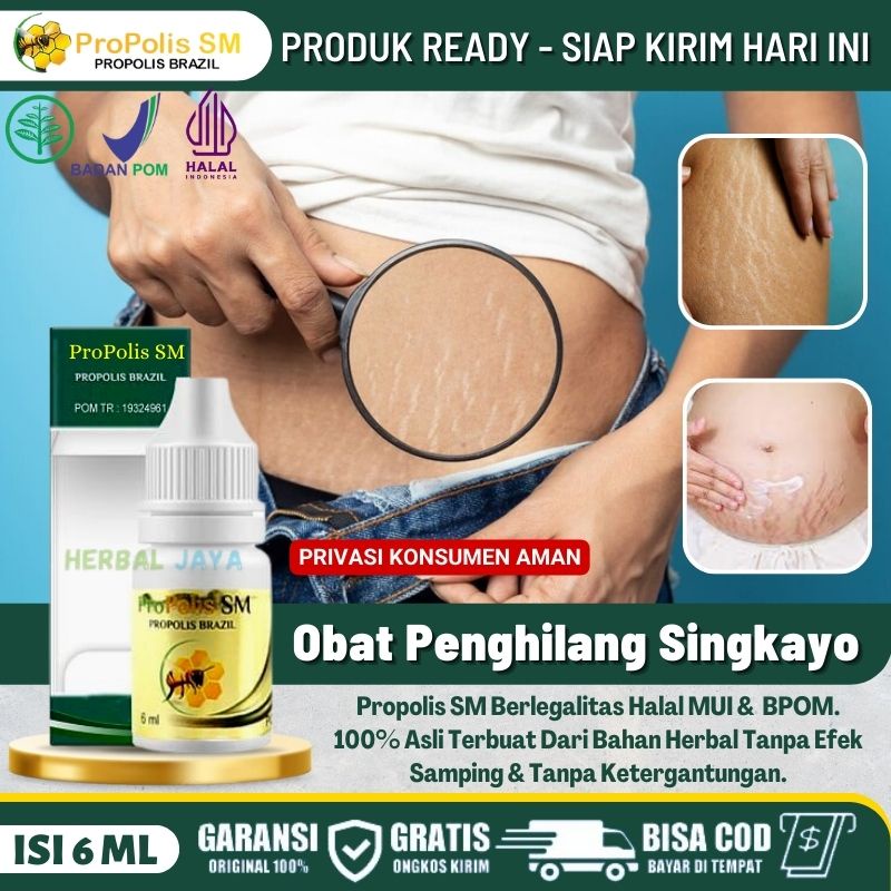 AMAN BPOM - Obat Pemudar Singkayo di Perut dll, Obat Tetes Memudarkan Singkayo / Stretch Mark, Obat 
