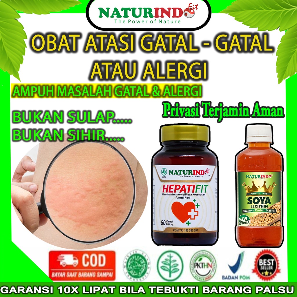 Obat Biduran Gatal Gatal Kulit Alergi Dingin Paling Ampuh Obat Gatel Gatel Bentol Bentol Kulit Eksim