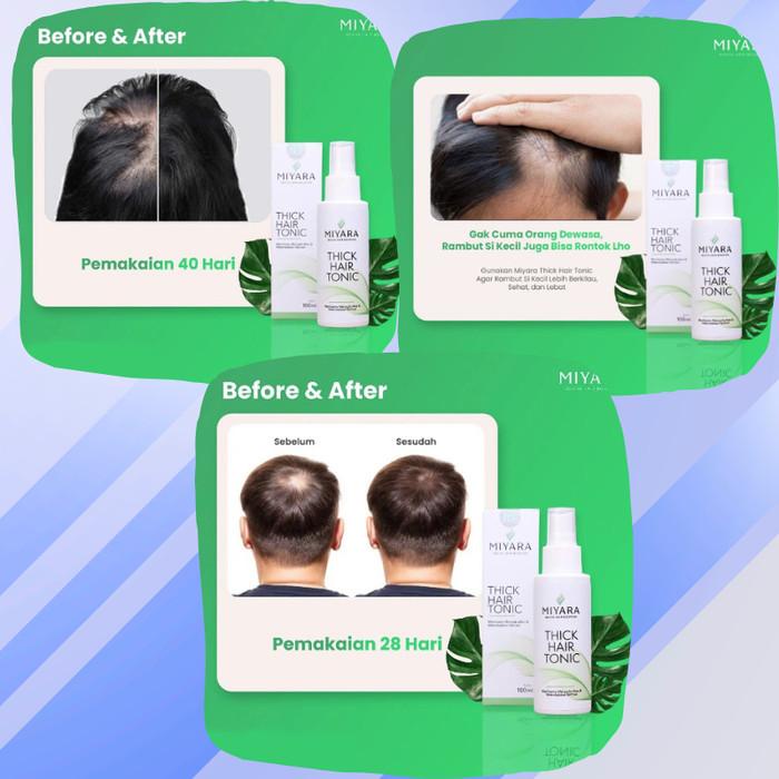 MIYARA HAIR TONIC Penumbuh Rambut Botak Alami