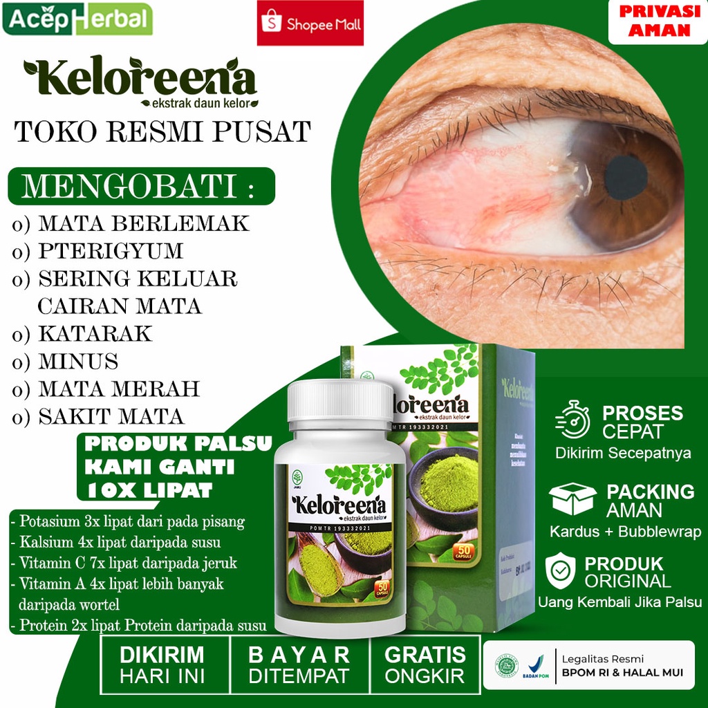 Obat Mata Pterigium Berlemak Atasi Mata Berembun Mata Berasap Penghilang Lamad Lemak Di Selaput Mata