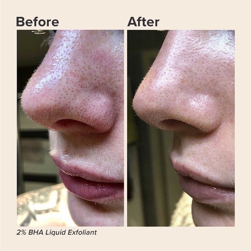 USA ORIGINAL Paula's Choice Skin Perfecting 2% BHA Liquid Salicylic Acid Exfoliating Toner Paulas Choice 2% BHA 118ml