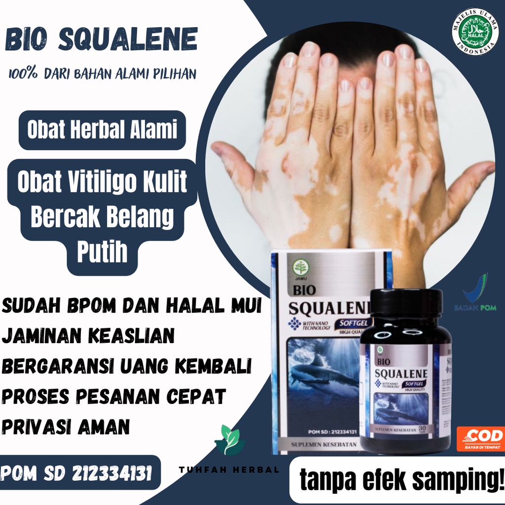 Obat Vitiligo Kulit Bercak Belang Putih, Obat Vitiligo di Tangan, Obat Vitiligo di Wajah, Obat Pengh