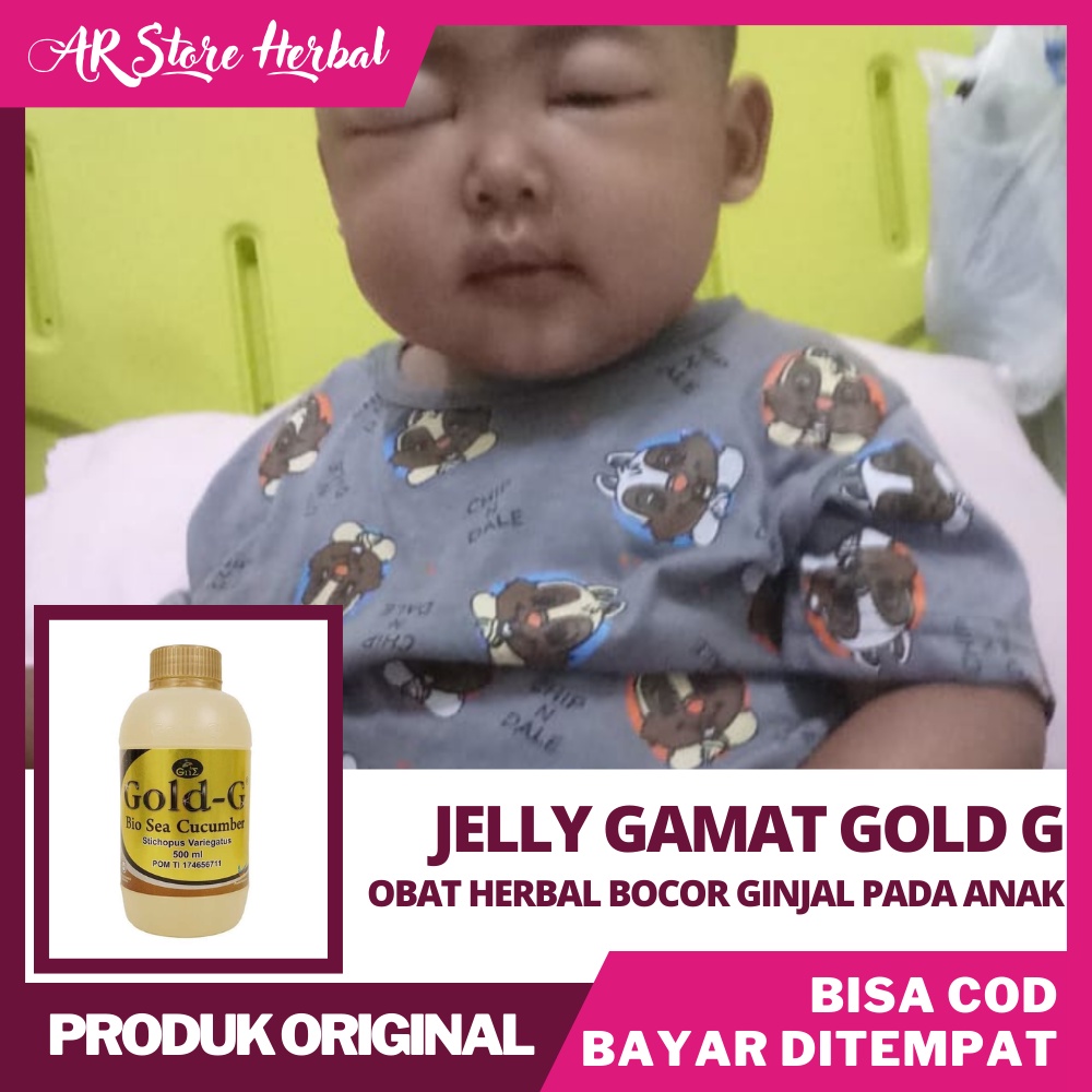 Obat Ginjal Bocor, Sindrom Nefrotik, Bocor Ginjal, Ginjal Bocor Pada Anak, , Obat Penyakit Ginjal Bo