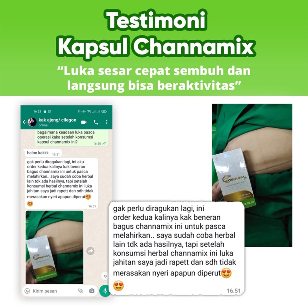 Kapsul Herbal Channamix Extrak Ikan Gabus Sari Kutuk Dan Royal Jelly Original