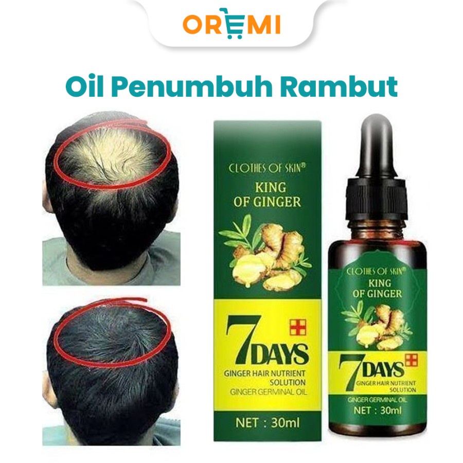 Mengurangi Rambut Rontok Serum Essence King Of Ginger Hair Serum Oil 7 days Clothes of skin