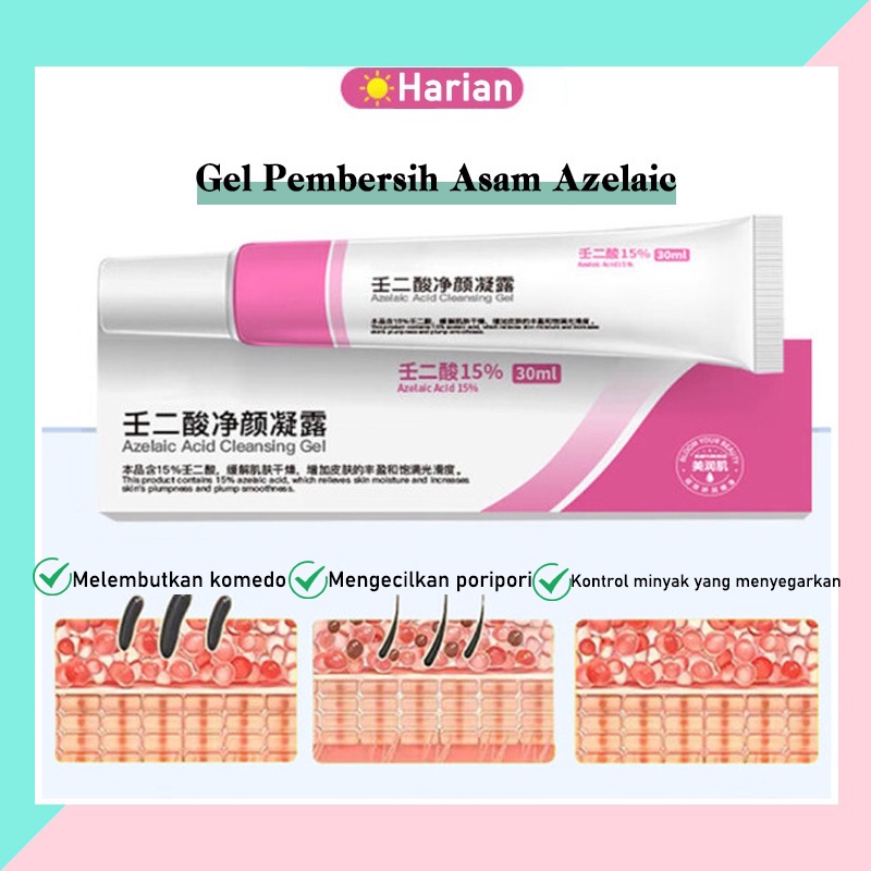 Mengecilkan Pori pori besar Serum wajah Acne gel jerawat 30G Menyegarkan kontrol minyak komedo mengecilkan pori-pori Meningkatkan jerawat dan kulit kasar Melembabkan dan meremajakan Menghilangkan jerawat, komedo, pori-pori besar