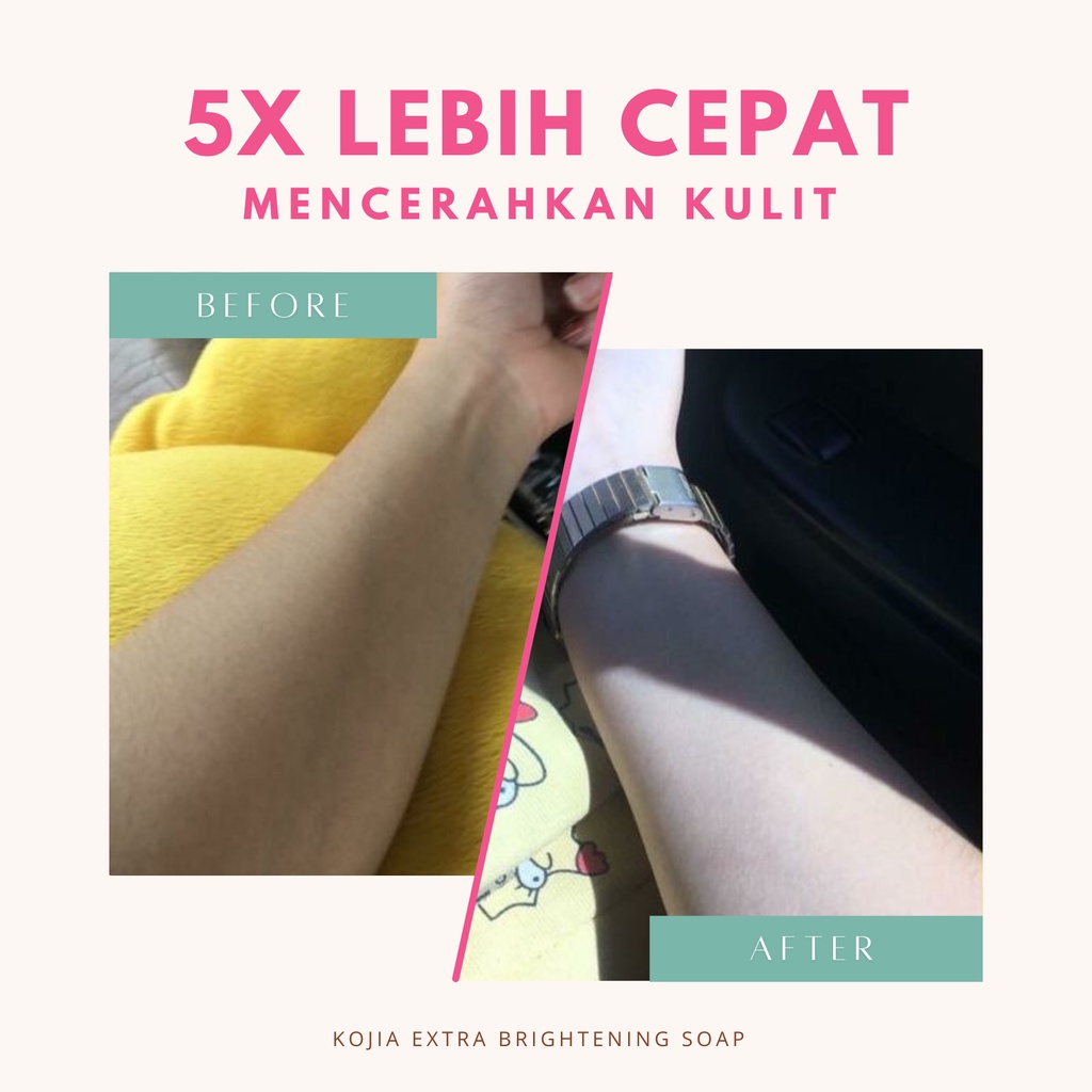 Kojia - Extra Brightening Soap | Sabun Pencerah Pemutih Badan Wajah Permanen Ampuh BPOM by rempahgadis