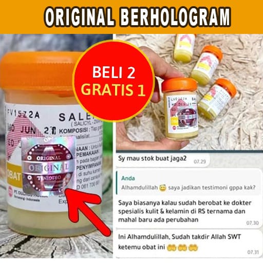 Salep Gatal Ampuh Obat Kulit Salep 24  Original Kutu Air Eksim Panu Kurap Biduran Gudik Scabies