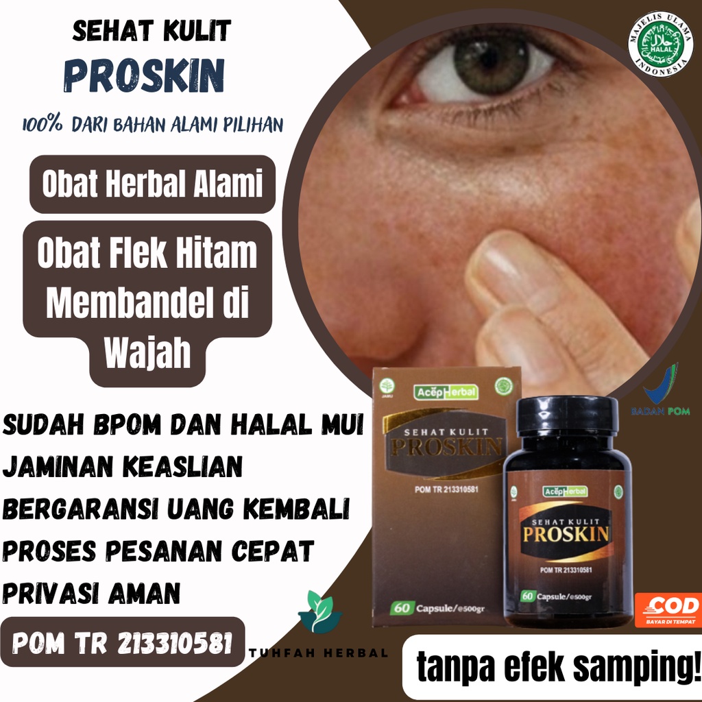 Obat Flek Hitam, Obat Flek Hitam di Wajah, Obat Flek Hitam Membandel, Flek Hitam Di Wajah Susah Hila