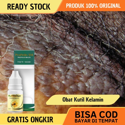 Obat Kutil Kelamin Wanita, Obat Kutil Kelamin Pria, Obat Kutil Kelamin HPV, Obat Perontok Kutil Kela