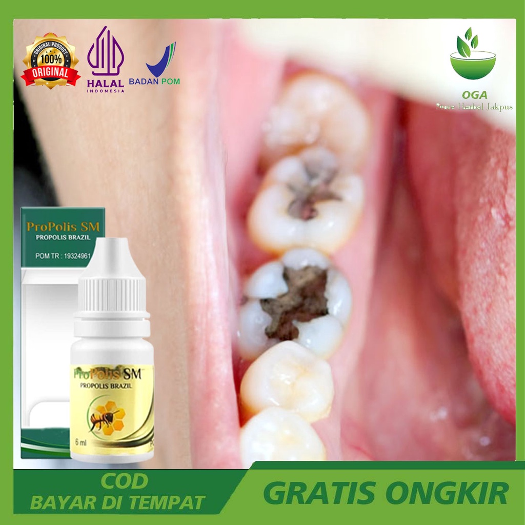 Obat Pembunuh Ulat Gigi di Apotik - Cara Mengeluarkan Ulat Gigi - Ulat Dalam Gigi Yang Berlubang - C