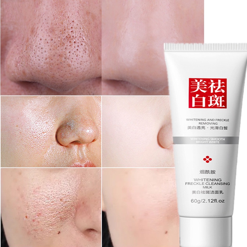 Whitening Cleanser-Nicotinamide Face Cleanser Facial Scrub Cleansing Acne Oil Control Blackhead Remover Freckles Facial Cleanser 60g