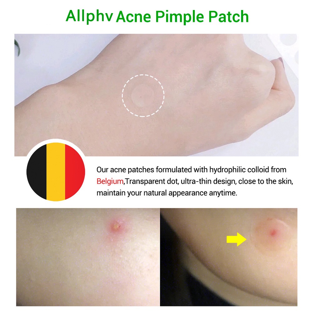 BREYLEE / ALLPHV Acne Pimple Patch Removal Penghilang Jerawat Day Use 0.1mm and Night Use 0.3mm (22 stiker)