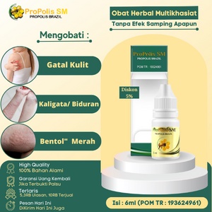 Obat gatal kulit, Obat Alergi Gatal Kulit, Obat Gatal Alergi, Obat Biduran Alergi yg Ampu h, No Obat