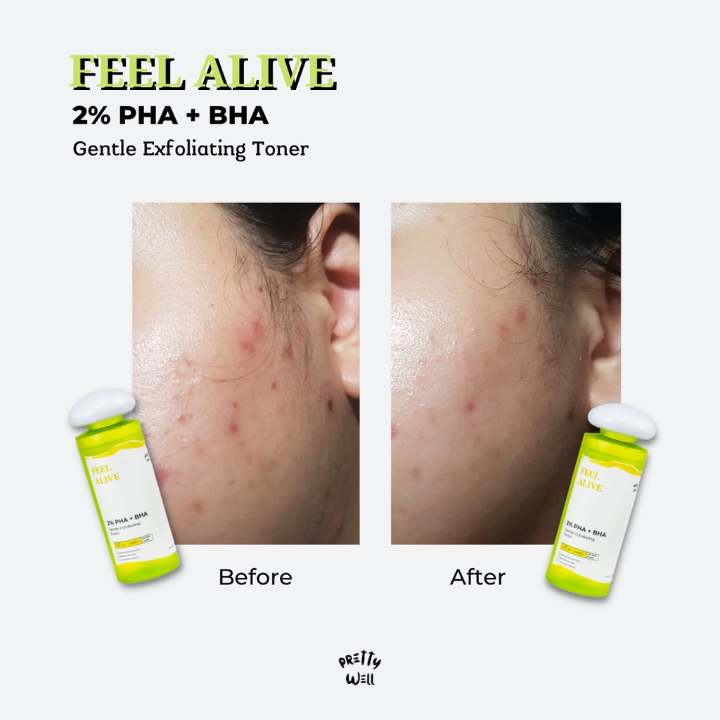 ❤ MEMEY ❤ PRETTYWELL Feel Alive 2% PHA + BHA Gentle Exfoliating Toner 100ml