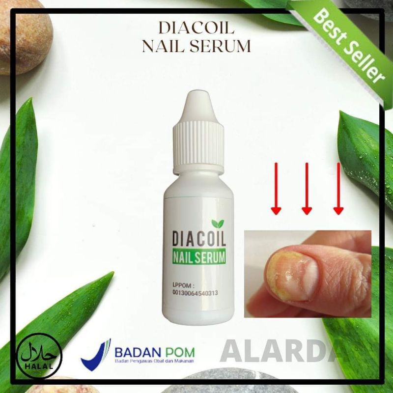 DIACOIL SERUM KUKU CANTENGAN DAN KUKU BERNANAH