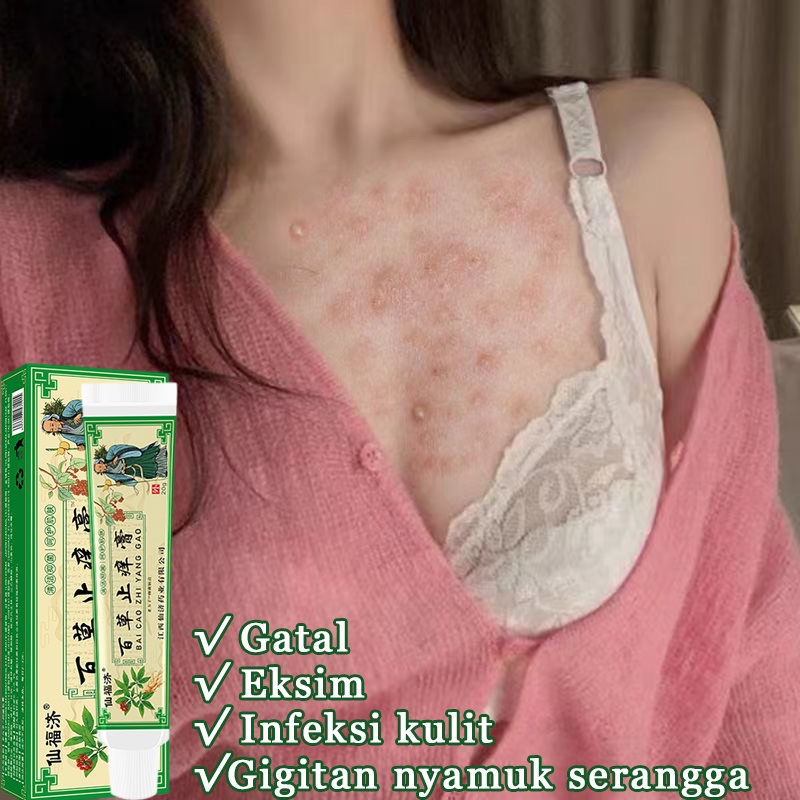 [100% Asli ] Salep Baicao anti pruritus, salep anti pruritus, gigitan nyamuk serangga, menghilangkan