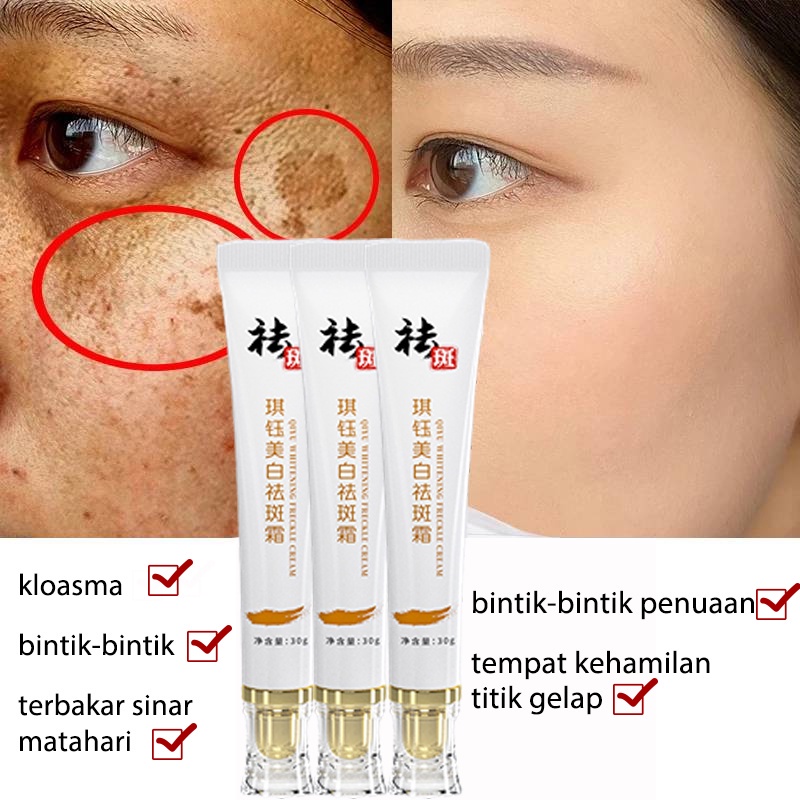 Cream Penghilang Flek Hitam Krim Penghilang Flek Cream Pemutih Wajah 30g Pemutih Asli Dan Penghilang Bintik Memudarkan Bintik, Bintik Matahari, Melasma Dan Melanin