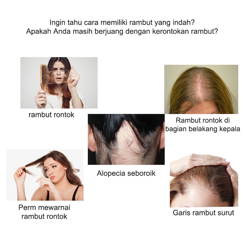 Ginge Esensi Semprotan jahe Ginger Hair Growth Essence 30ml Hair Oil Serum Rambut Anti Rontok Mempercepat Pertumbuhan Rambut Botak Rontok germinal rambut Perawatan