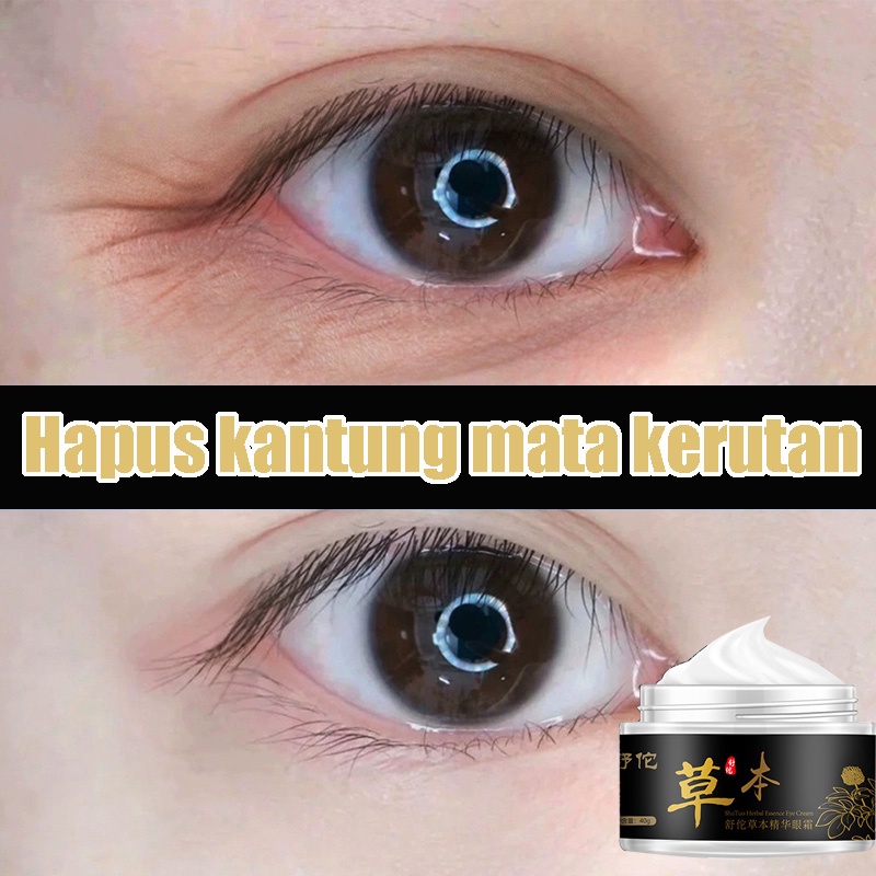 Anti-Wrinkle Firming Eye Cream activating close repair eye Treatment cream30g Krim Mata Atasi Kerutan, Garis Halus, Kantung Mata, Dan Mata Panda Dengan Peptide