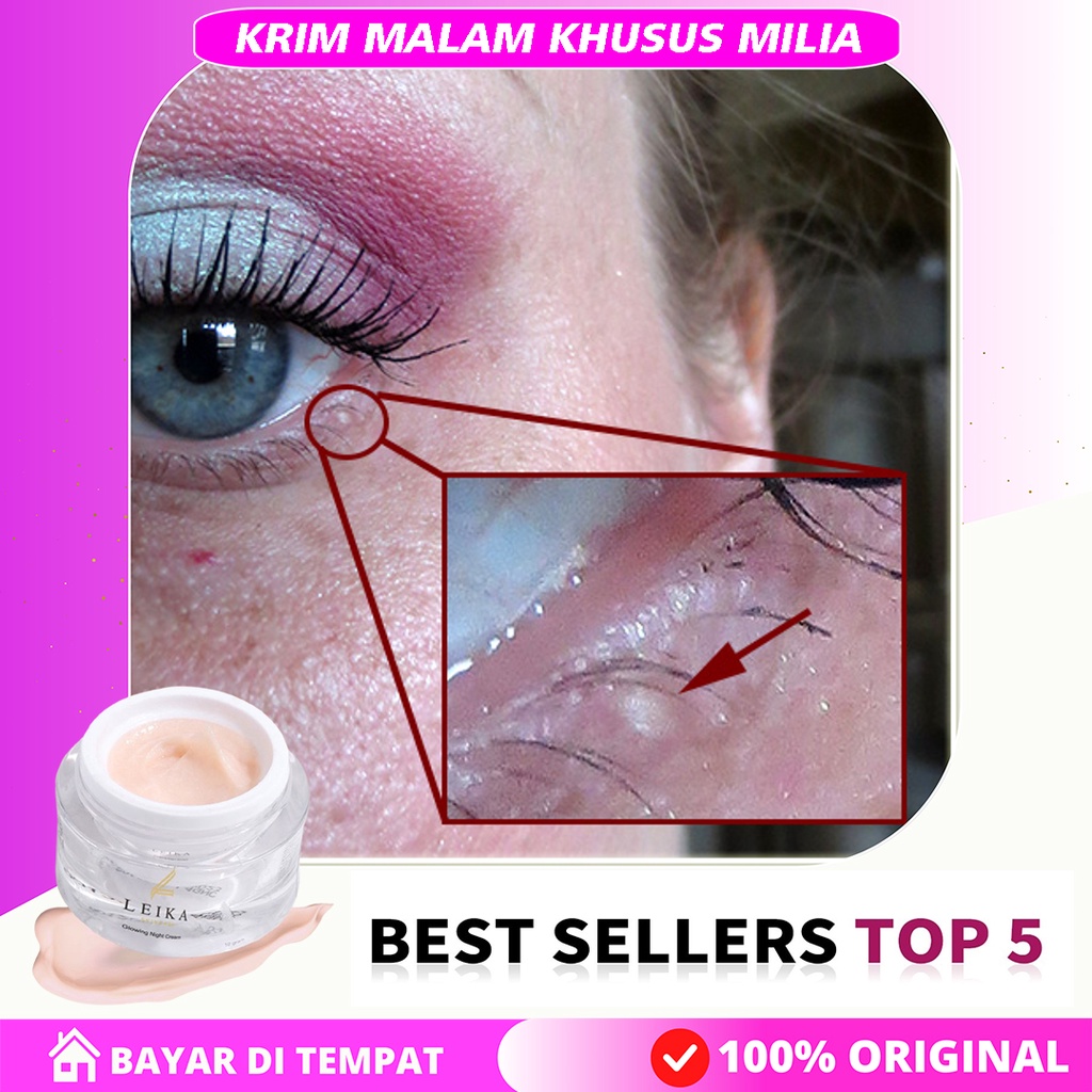 Obat Milia Yang Sudah Bertahun Tahun - Serum Milea - Serum Milia - Serum Penghilang Milea dan Bruntu