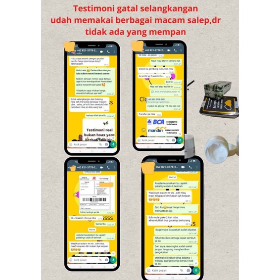 SABUN AKUI - SABUN ANTI GATAL Sabun Akui mengandung Bahan Aktif yang mampu membasmi Jamur sehingga tidak Mampu Bertahan lama Pemakaian yang teratur setiap hari menjadikan kulit terbebas dari jamur/kuman/bakteri yang mengakibatkan gatal