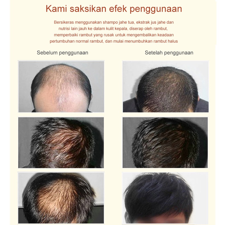 Ginge Esensi Ginger Hair Growth Essence Hair Treatment Serum 30ml Hair Oil Serum Rambut Anti Rontok Mempercepat Pertumbuhan Rambut Botak Khusus untuk rambut rontok